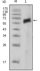 AXL Antibody - Western blot using AXL mouse monoclonal antibody against extracellular domain of human AXL (aa19-444) fused to human IgGFc (recombinant protein used as the immunogen).
Lane M, size markers; Lane 1, recombinant protein. Expected size is ~68 kDa.
