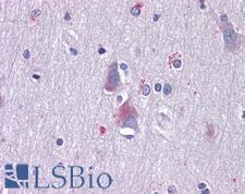 AXL Antibody - Anti-AXL antibody IHC of human brain, cortex. Immunohistochemistry of formalin-fixed, paraffin-embedded tissue after heat-induced antigen retrieval. Antibody dilution 1:200.