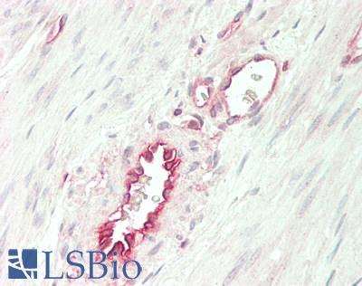 B2M / Beta 2 Microglobulin Antibody - Human Uterus, Vessels: Formalin-Fixed, Paraffin-Embedded (FFPE)