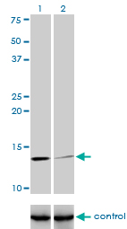 B2M / Beta 2 Microglobulin Antibody - Western blot of B2M over-expressed 293 cell line, cotransfected with B2M Validated Chimera RNAi (Lane 2) or non-transfected control (Lane 1). Blot probed with B2M monoclonal antibody, clone 3F9-2C2. GAPDH ( 36.1 kD ) used as specificity a.