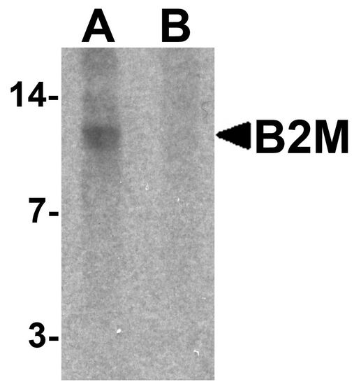 B2M / Beta 2 Microglobulin Antibody - Western blot analysis of B2M in SK-N-SH cell lysate with B2M antibody at 1 ug/ml in (A) the absence and (B) the presence of blocking peptide.