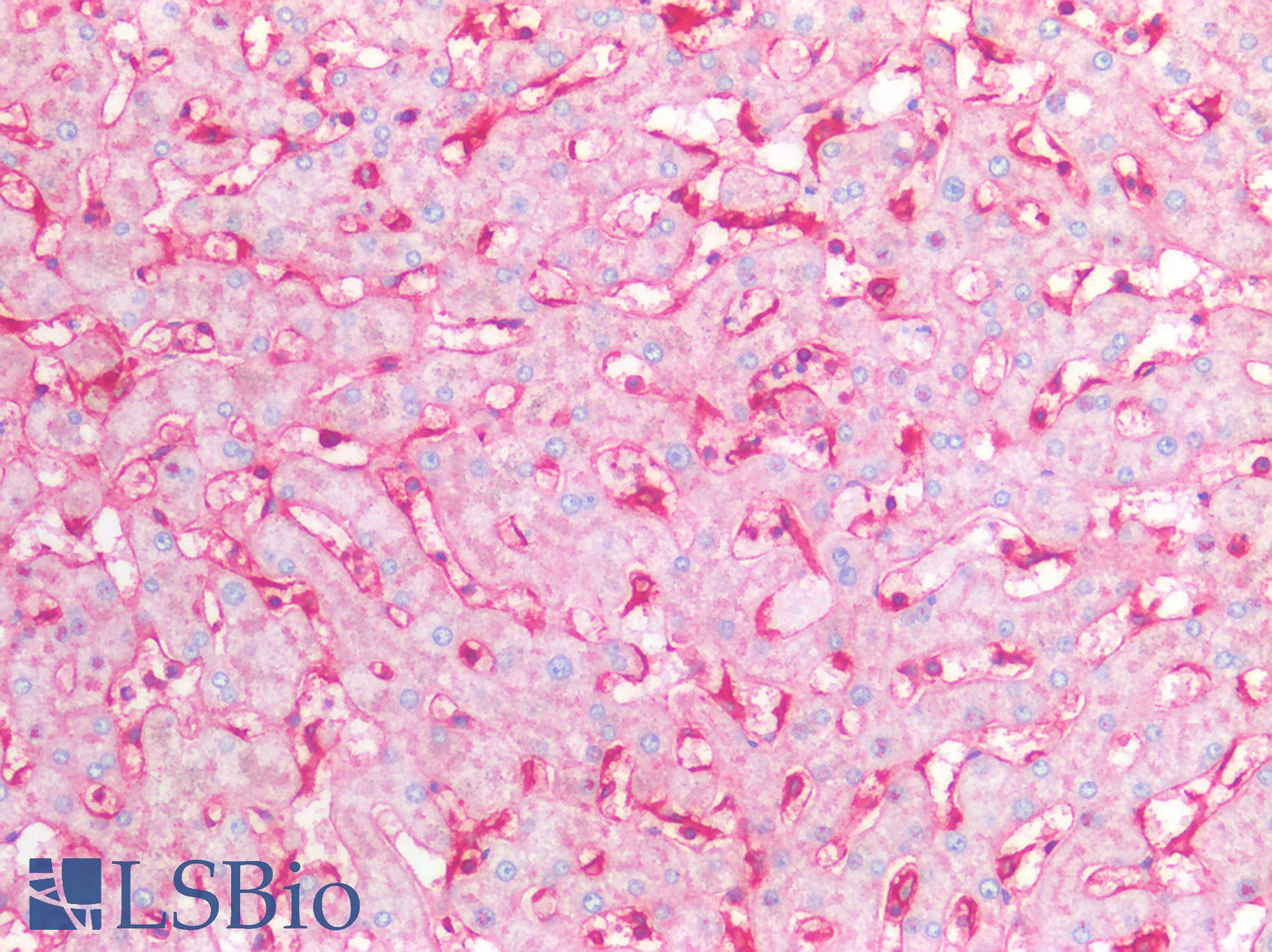 B2M / Beta 2 Microglobulin Antibody - Human Liver: Formalin-Fixed, Paraffin-Embedded (FFPE)