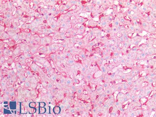 B2M / Beta 2 Microglobulin Antibody - Human Liver: Formalin-Fixed, Paraffin-Embedded (FFPE)