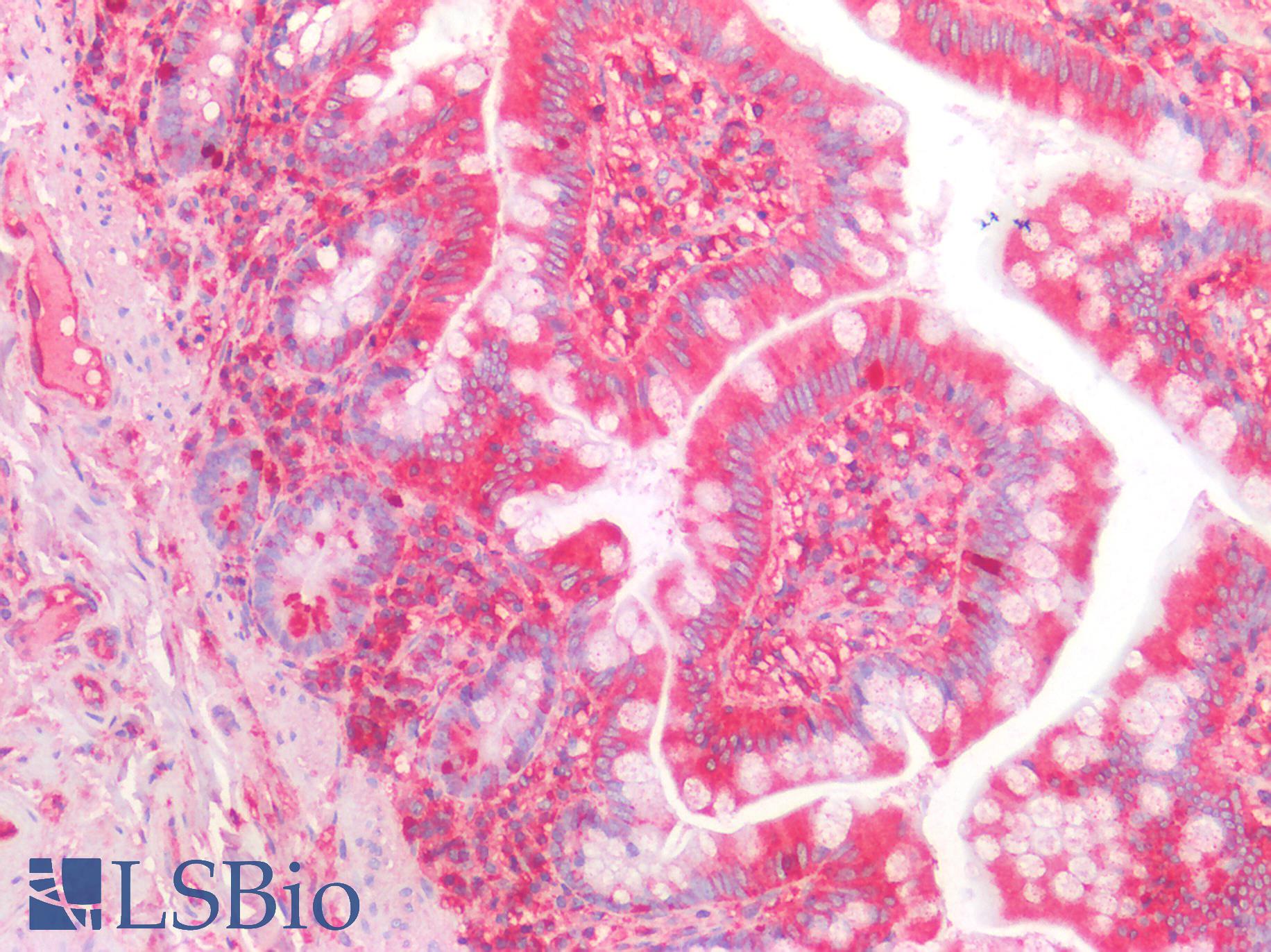 B2M / Beta 2 Microglobulin Antibody - Human Small Intestine: Formalin-Fixed, Paraffin-Embedded (FFPE)