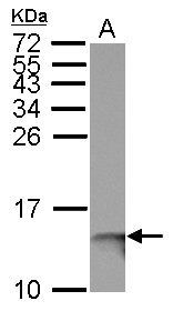 B2M / Beta 2 Microglobulin Antibody - Sample (30 ug of whole cell lysate) A: A431 15% SDS PAGE B2M antibody diluted at 1:5000