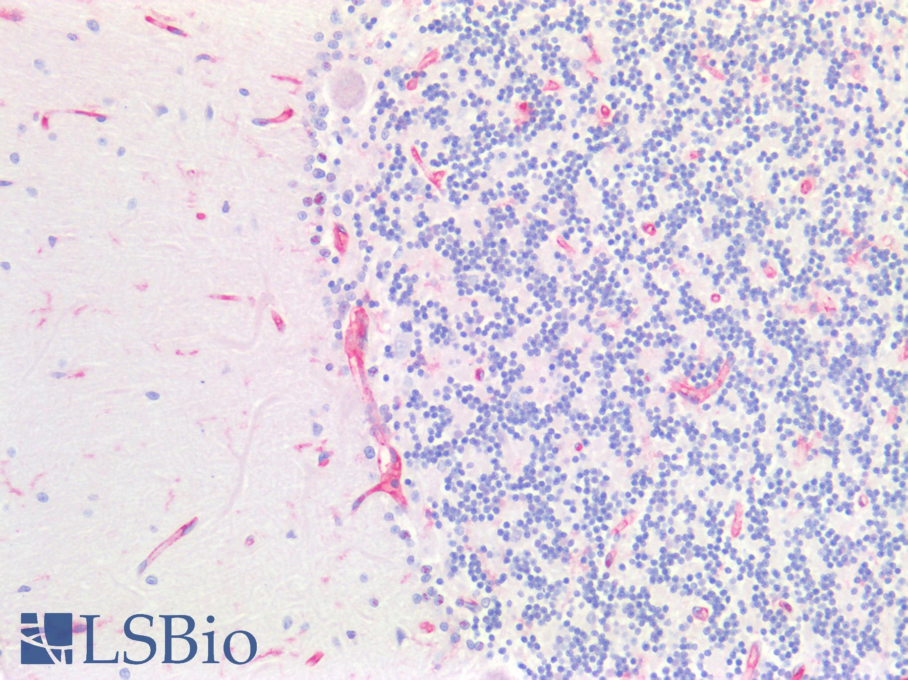 B2M / Beta 2 Microglobulin Antibody - Human Brain, Cerebellum: Formalin-Fixed, Paraffin-Embedded (FFPE)