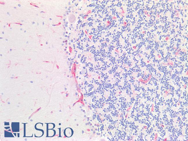 B2M / Beta 2 Microglobulin Antibody - Human Brain, Cerebellum: Formalin-Fixed, Paraffin-Embedded (FFPE)