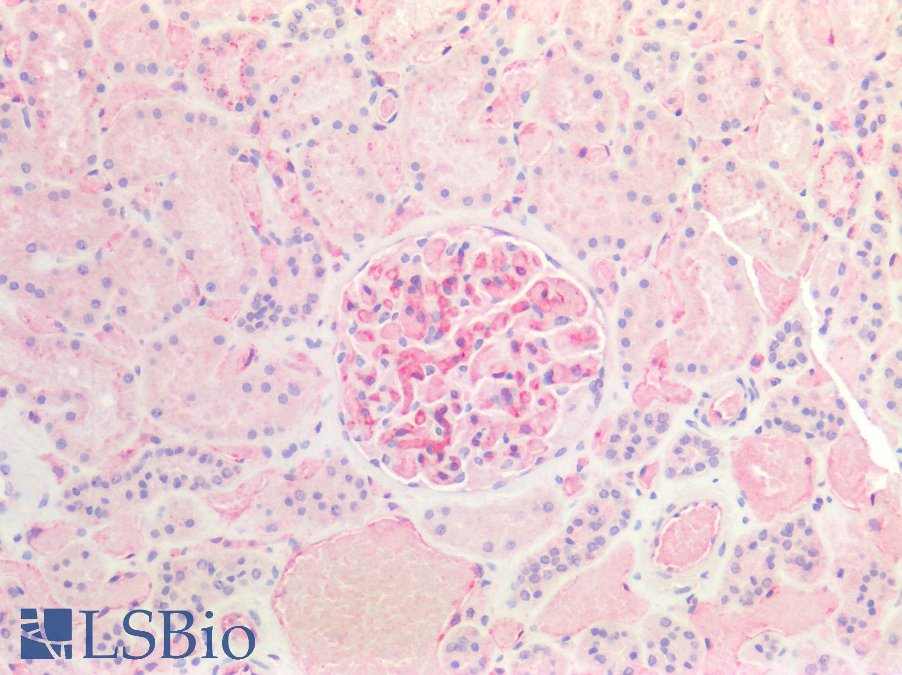 B2M / Beta 2 Microglobulin Antibody - Human Kidney: Formalin-Fixed, Paraffin-Embedded (FFPE)