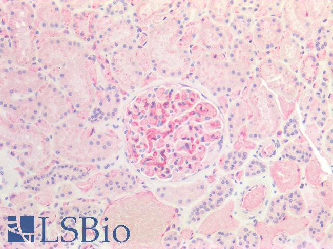 B2M / Beta 2 Microglobulin Antibody - Human Kidney: Formalin-Fixed, Paraffin-Embedded (FFPE)