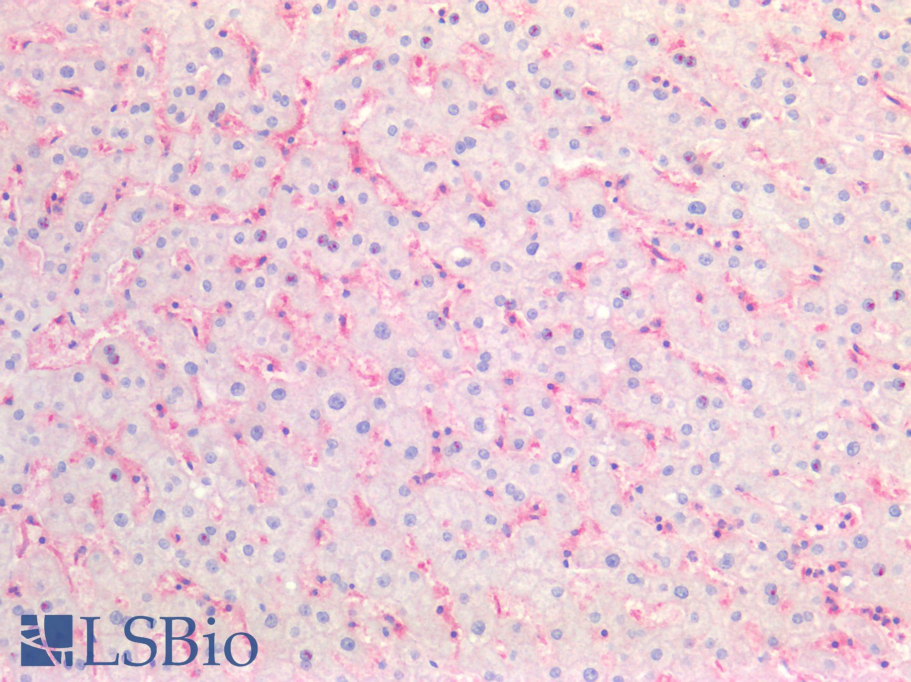 B2M / Beta 2 Microglobulin Antibody - Human Liver: Formalin-Fixed, Paraffin-Embedded (FFPE)