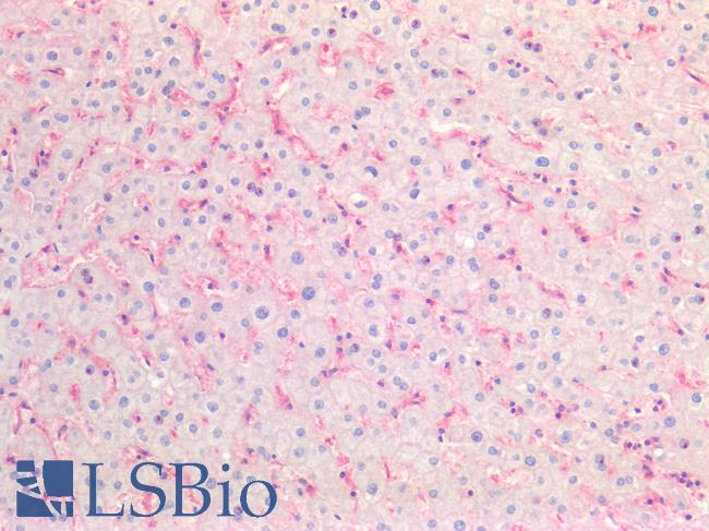 B2M / Beta 2 Microglobulin Antibody - Human Liver: Formalin-Fixed, Paraffin-Embedded (FFPE)