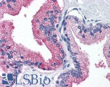 B2M / Beta 2 Microglobulin Antibody - Anti-B2M antibody IHC of human prostate. Immunohistochemistry of formalin-fixed, paraffin-embedded tissue after heat-induced antigen retrieval. Antibody concentration 10 ug/ml.