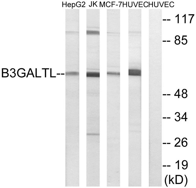 B3GALTL Antibody - Western blot analysis of lysates from HUVEC, MCF-7, Jurkat, and HepG2 cells, using B3GALTL Antibody. The lane on the right is blocked with the synthesized peptide.
