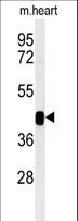 B3GNT7 Antibody - Western blot of B3GNT7 Antibody in mouse heart tissue lysates (35 ug/lane). B3GNT7 (arrow) was detected using the purified antibody.