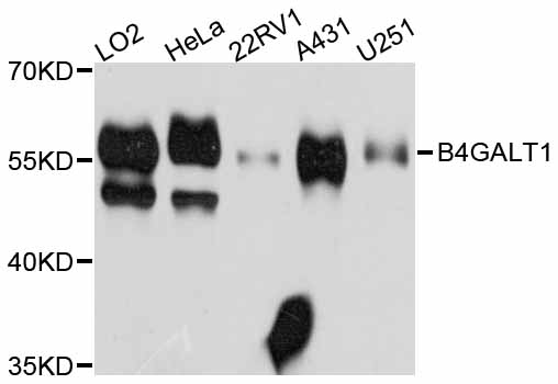 B4GALT1 Antibody - Western blot analysis of extracts of various cell lines.