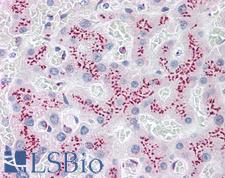 B4GALT1 Antibody - Human Liver: Formalin-Fixed, Paraffin-Embedded (FFPE)