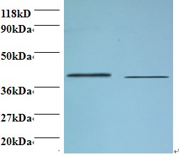 B4GALT3 Antibody - Western blot of Beta-1,4-galactosyltransferase 3 antibody at 2 ug/ml. Lane 1: EC109 whole cell lysate. Lane 2: 293T whole cell lysate. Secondary: Goat polyclonal to Rabbit IgG at 1:15000 dilution. Predicted band size: 43 kDa. Observed band size: 43 kDa.  This image was taken for the unconjugated form of this product. Other forms have not been tested.
