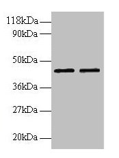 B4GALT3 Antibody - Western blot All lanes: Beta-1, 4-galactosyltransferase 3 antibody at 2µg/ml Lane 1: EC109 whole cell lysate Lane 2: 293T whole cell lysate Secondary Goat polyclonal to rabbit IgG at 1/15000 dilution Predicted band size: 44, 16 kDa Observed band size: 44 kDa