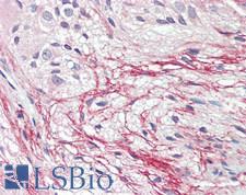 B4GAT1 / B3GNT1 Antibody - Human Small Intestine, Myenteric Plexus: Formalin-Fixed, Paraffin-Embedded (FFPE), at a concentration of 10 ug/ml.