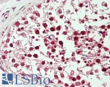 BABAM1 / HSPC142 Antibody - Human Testis: Formalin-Fixed, Paraffin-Embedded (FFPE)