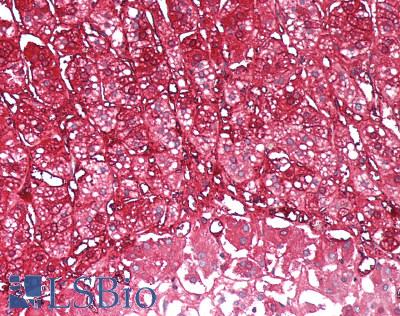BABP / AKR1C2 Antibody - Human Adrenal: Formalin-Fixed, Paraffin-Embedded (FFPE), at a dilution of 1:100. 