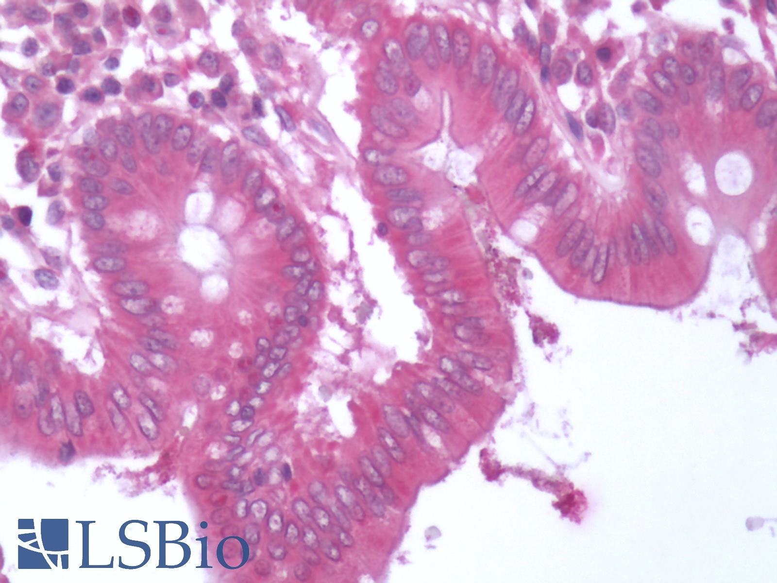 BACE1 / BACE Antibody - Human Colon: Formalin-Fixed, Paraffin-Embedded (FFPE)