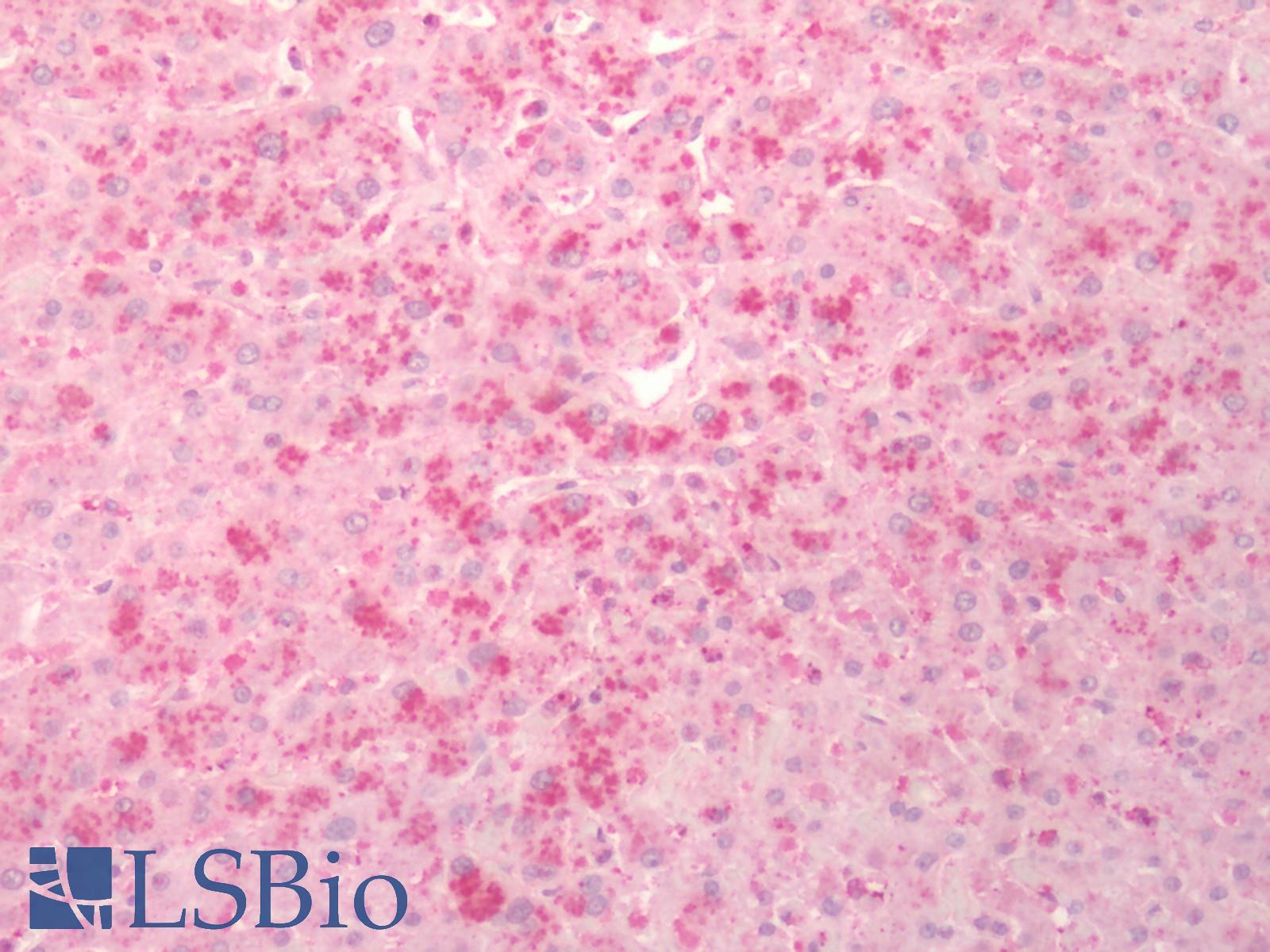 BACE1 / BACE Antibody - Human Liver: Formalin-Fixed, Paraffin-Embedded (FFPE)