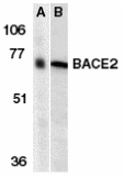 BACE2 Antibody - Western blot of BACE2 in human (A) and mouse (B) heart tissue lysates with BACE2 antibody at 1 ug/ml.