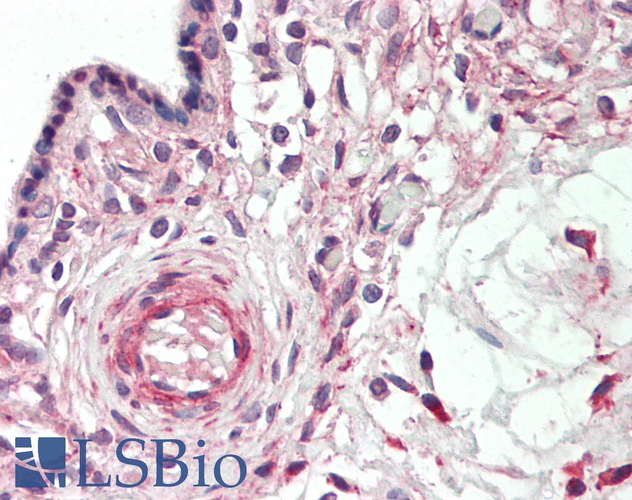 BACH1 Antibody - Human Placenta: Formalin-Fixed, Paraffin-Embedded (FFPE)