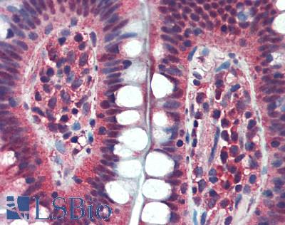 BACH1 Antibody - Human Small Intestine: Formalin-Fixed, Paraffin-Embedded (FFPE)