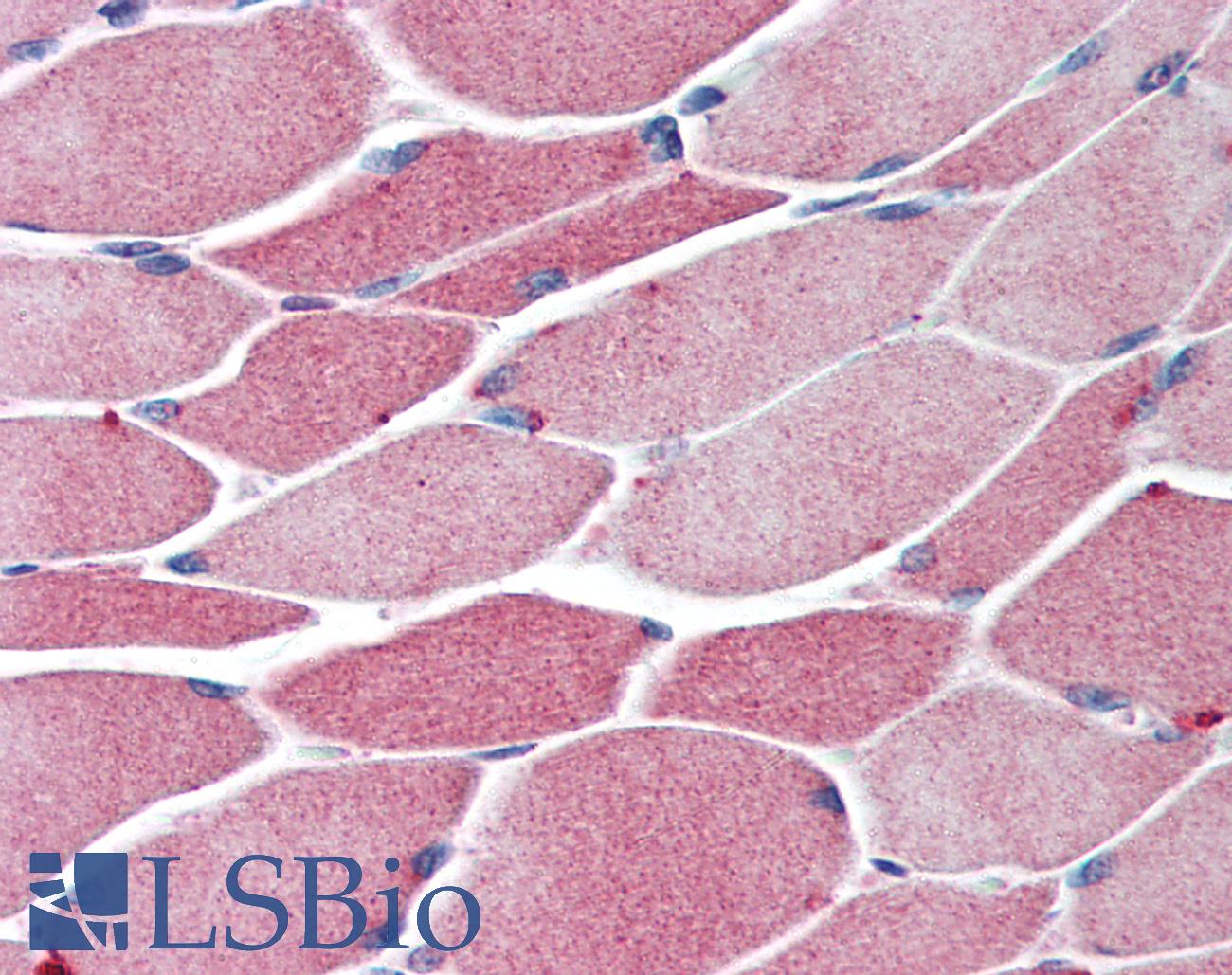 BACH1 Antibody - Anti-BACH1 antibody IHC of human skeletal muscle. Immunohistochemistry of formalin-fixed, paraffin-embedded tissue after heat-induced antigen retrieval. Antibody concentration 5 ug/ml.