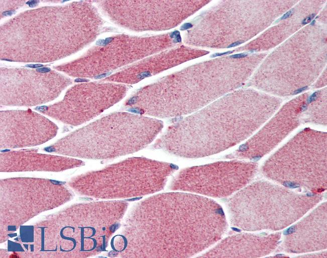 BACH1 Antibody - Anti-BACH1 antibody IHC of human skeletal muscle. Immunohistochemistry of formalin-fixed, paraffin-embedded tissue after heat-induced antigen retrieval. Antibody concentration 5 ug/ml.