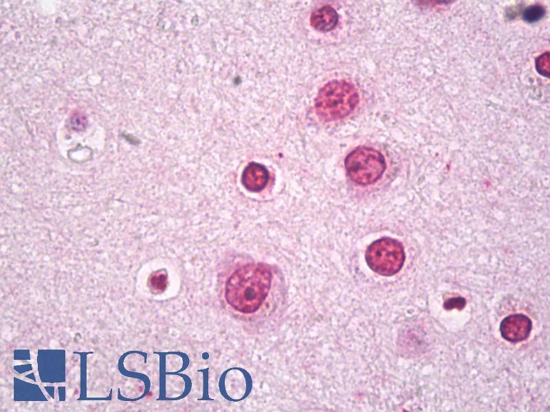 BACH2 Antibody - Anti-BACH2 antibody IHC of human brain, cortex neurons. Immunohistochemistry of formalin-fixed, paraffin-embedded tissue after heat-induced antigen retrieval. Antibody concentration 10 ug/ml.