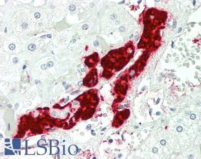 BAD Antibody - Human Adrenal: Formalin-Fixed, Paraffin-Embedded (FFPE)