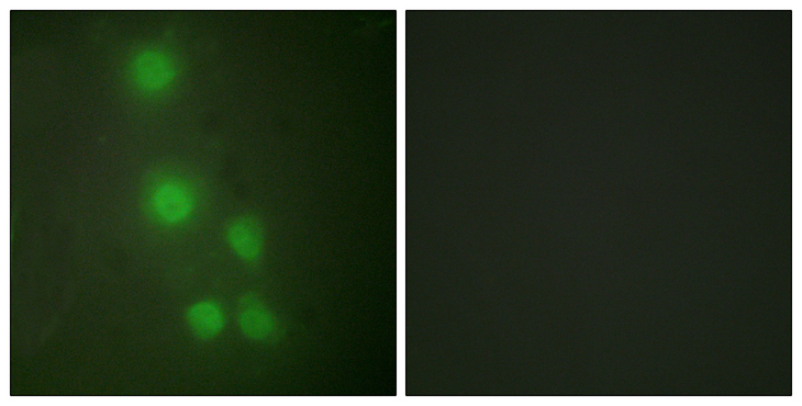 BAF53 / ACTL6A Antibody - Immunofluorescence analysis of HUVEC cells, using ACTL6A Antibody. The picture on the right is blocked with the synthesized peptide.