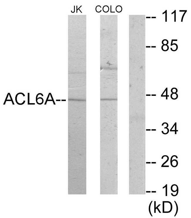 BAF53 / ACTL6A Antibody - Western blot analysis of lysates from Jurkat and COLO205 cells, using ACTL6A Antibody. The lane on the right is blocked with the synthesized peptide.