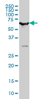 BAF60B / SMARCD2 Antibody - SMARCD2 monoclonal antibody clone 2F7 Western blot of SMARCD2 expression in HeLa NE.