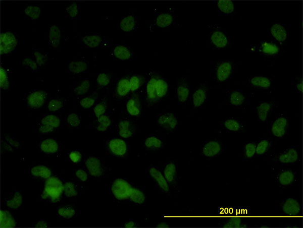 BAF60B / SMARCD2 Antibody - Immunofluorescence of monoclonal antibody to SMARCD2 on HeLa cell. [antibody concentration 10 ug/ml]