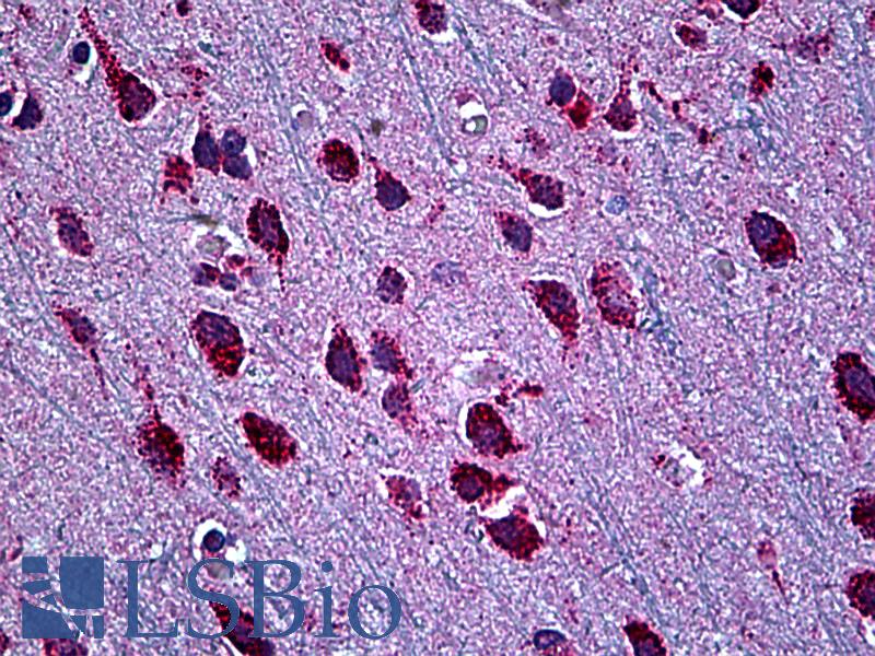 BAF60B / SMARCD2 Antibody - Anti-SMARCD2 antibody IHC of human brain, cortex. Immunohistochemistry of formalin-fixed, paraffin-embedded tissue after heat-induced antigen retrieval. Antibody concentration 5 ug/ml.