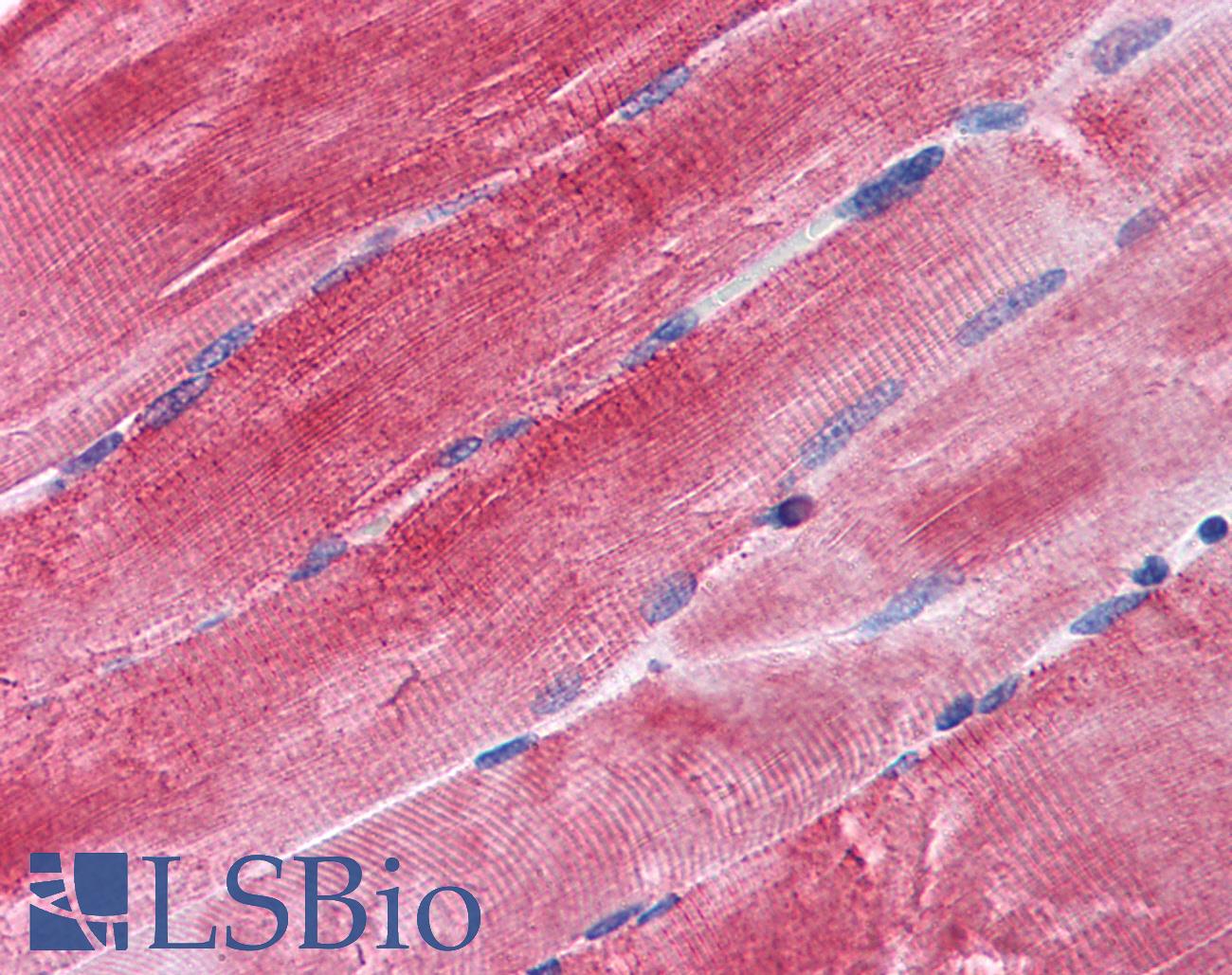 BAG3 / BAG-3 Antibody - Anti-BAG3 antibody IHC of human skeletal muscle. Immunohistochemistry of formalin-fixed, paraffin-embedded tissue after heat-induced antigen retrieval. Antibody concentration 3.75 ug/ml.
