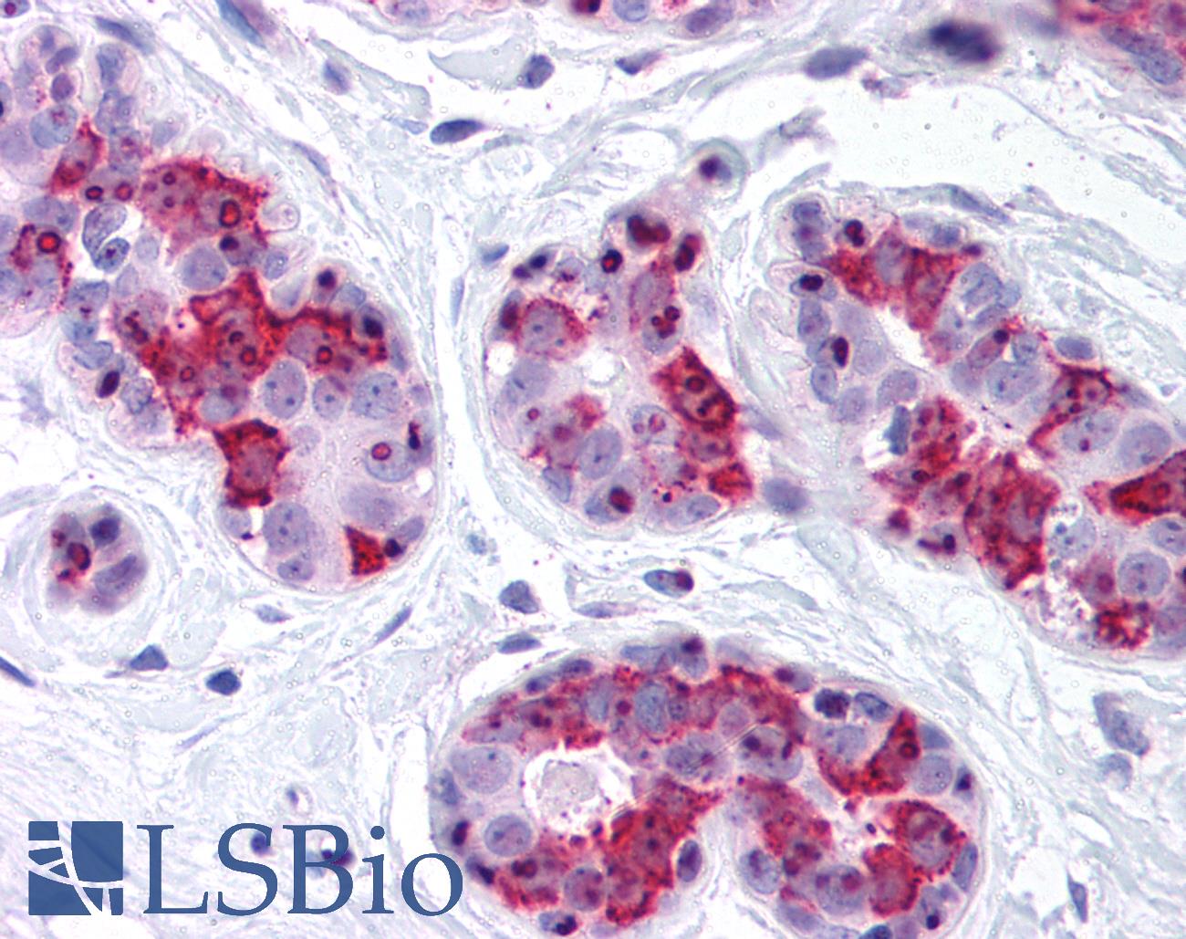 BAG5 Antibody - Anti-BAG5 antibody IHC of human breast. Immunohistochemistry of formalin-fixed, paraffin-embedded tissue after heat-induced antigen retrieval. Antibody concentration 20 ug/ml.