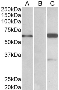BAIAP2 / IRSP53 Antibody - HEK293 lysate (10ug protein in RIPA buffer) over expressing Human BAIAP2 with DYKDDDDK tag probed with (1.0 ug/ml) in Lane A and probed with anti- DYKDDDDK Tag (1/3000) in lane C. Mock-transfected HEK293 probed (1mg/ml) in Lane B. Pri