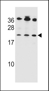 BAK1 / BAK Antibody - Bak Antibody (BH3) western blot of Jurkat,MDA-MB453,293 cell line lysates (35 ug/lane). The Bak antibody detected the Bak protein (arrow).