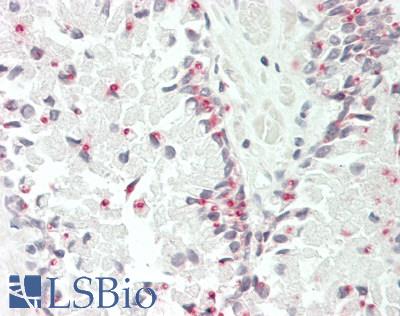 BAK1 / BAK Antibody - Human Prostate: Formalin-Fixed, Paraffin-Embedded (FFPE)