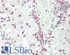 BAK1 / BAK Antibody - Human Prostate: Formalin-Fixed, Paraffin-Embedded (FFPE)