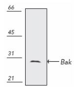 BAK1 / BAK Antibody - Western blot of human epidermoid carcinoma A431 cell lysate.