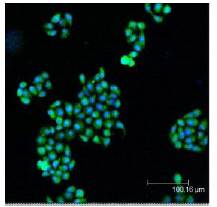 BAK1 / BAK Antibody - Confocal immunofluorescent staining of He La cells using BAK1 / BAK Antibody (green); nuclei are stained in blue pseudocolor using DRAQ5.