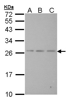 BAK1 / BAK Antibody - Sample (30 ug of whole cell lysate). A: Hela. B: Hep G2. C: Molt-4. 12% SDS PAGE. BAK1 antibody diluted at 1:1000. 