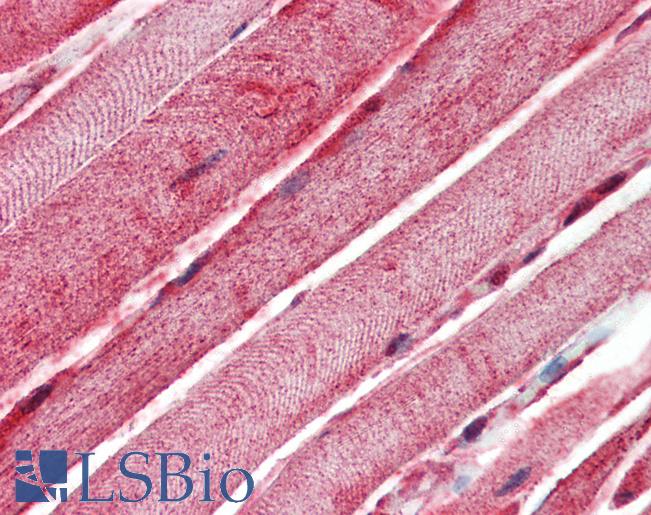 BAK1 / BAK Antibody - Anti-BAK1 / BAK antibody IHC of human skeletal muscle. Immunohistochemistry of formalin-fixed, paraffin-embedded tissue after heat-induced antigen retrieval. Antibody concentration 10 ug/ml.