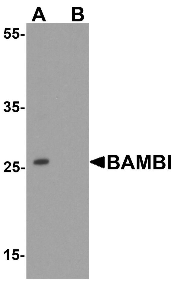 BAMBI Antibody - Western blot analysis of BAMBI in mouse lung tissue lysate with Anti-BAMBI antibody at 1 ug/ml in (A) the absence and (B) the presence of blocking peptide.